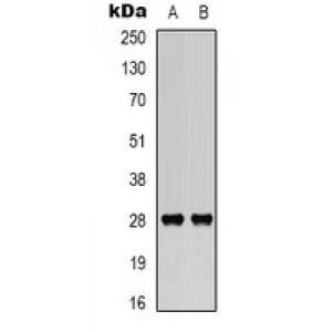 LifeSab™ BCL2 (pS70) Rabbit pAb (50 µl)
