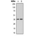 LifeSab™ HGF activator Rabbit pAb (50 µl)