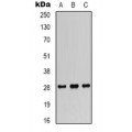 LifeSab™ ANGPTL1 Rabbit pAb (50 µl)