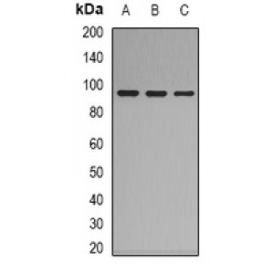 LifeSab™ Factor XIII B Rabbit pAb (50 µl)