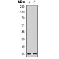 LifeSab™ VEGFC Rabbit pAb (50 µl)