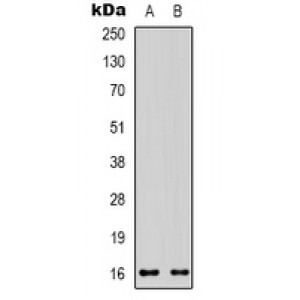 LifeSab™ VEGFC Rabbit pAb (50 µl)