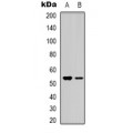 LifeSab™ CCL27 Rabbit pAb (50 µl)