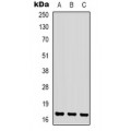 LifeSab™ S100-A1 Rabbit pAb (50 µl)