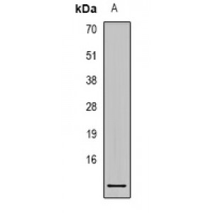 LifeSab™ TP53INP2 Rabbit pAb (50 µl)