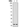 LifeSab™ Gamma-NaCH Rabbit pAb (50 µl)