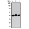 LifeSab™ CCR5 Rabbit pAb (50 µl)