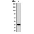 LifeSab™ FABP2 Rabbit pAb (50 µl)