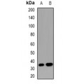LifeSab™ VEGFR3 Rabbit pAb (50 µl)