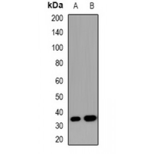 LifeSab™ VEGFR3 Rabbit pAb (50 µl)