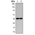 LifeSab™ GAT1 Rabbit pAb (50 µl)
