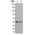 LifeSab™ CD21 Rabbit pAb (50 µl)