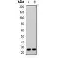 LifeSab™ CD64 Rabbit pAb (50 µl)