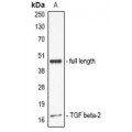 LifeSab™ IL-19 Rabbit pAb (50 µl)