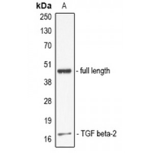 LifeSab™ IL-19 Rabbit pAb (50 µl)