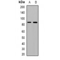 LifeSab™ TGFBR3 Rabbit pAb (50 µl)