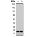 LifeSab™ RCC1 Rabbit pAb (50 µl)