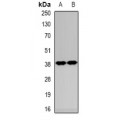 LifeSab™ MIB1 Rabbit pAb (50 µl)