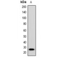 LifeSab™ Cytochrome P450 26B1 Rabbit pAb (50 µl)