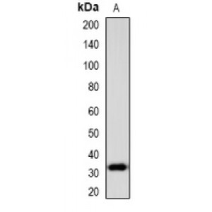 LifeSab™ Tachykinin Receptor 3 Rabbit pAb (50 µl)