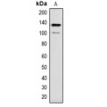 LifeSab™ CACNA2D3 Rabbit pAb (50 µl)
