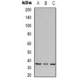 LifeSab™ CALHM1 Rabbit pAb (50 µl)