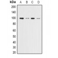 LifeSab™ Estrogen Receptor alpha Rabbit pAb (50 µl)
