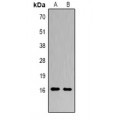 LifeSab™ Histone H3 (DiMethyl K14) Rabbit pAb (50 µl)