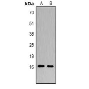 LifeSab™ Histone H3 (DiMethyl K14) Rabbit pAb (50 µl)