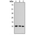 LifeSab™ Histone H3 (MonoMethyl R17) Rabbit pAb (50 µl)
