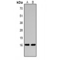 LifeSab™ Histone H3 (MonoMethyl R26) Rabbit pAb (50 µl)