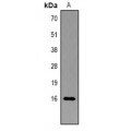 LifeSab™ Histone H3 (TriMethyl K18) Rabbit pAb (50 µl)