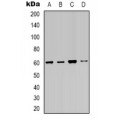 LifeSab™ Smooth Muscle Actin Rabbit pAb (50 µl)