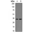 LifeSab™ XBP1 Rabbit pAb (50 µl)