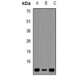 LifeSab™ FKBP12 Rabbit pAb (50 µl)