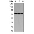 LifeSab™ PBGD Rabbit pAb (50 µl)