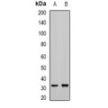 LifeSab™ RCAS1 Rabbit pAb (50 µl)
