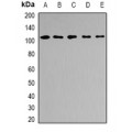 LifeSab™ AP2B1 Rabbit pAb (50 µl)