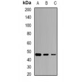 LifeSab™ SCCPDH Rabbit pAb (50 µl)