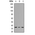 LifeSab™ Tpm2 Rabbit pAb (50 µl)
