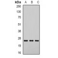 LifeSab™ DCXR Rabbit pAb (50 µl)
