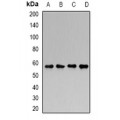 LifeSab™ GALNS Rabbit pAb (50 µl)