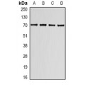 LifeSab™ LBR Rabbit pAb (50 µl)