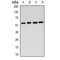 LifeSab™ FH Rabbit pAb (50 µl)
