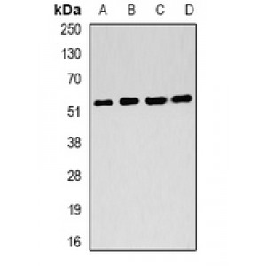 LifeSab™ FH Rabbit pAb (50 µl)