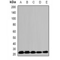LifeSab™ HPRT Rabbit pAb (50 µl)