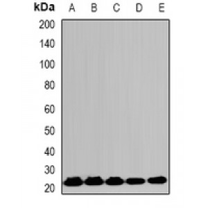 LifeSab™ HPRT Rabbit pAb (50 µl)