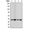 LifeSab™ TCN2 Rabbit pAb (50 µl)