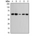 LifeSab™ TrpRS Rabbit pAb (50 µl)