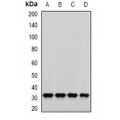 LifeSab™ PNP Rabbit pAb (50 µl)